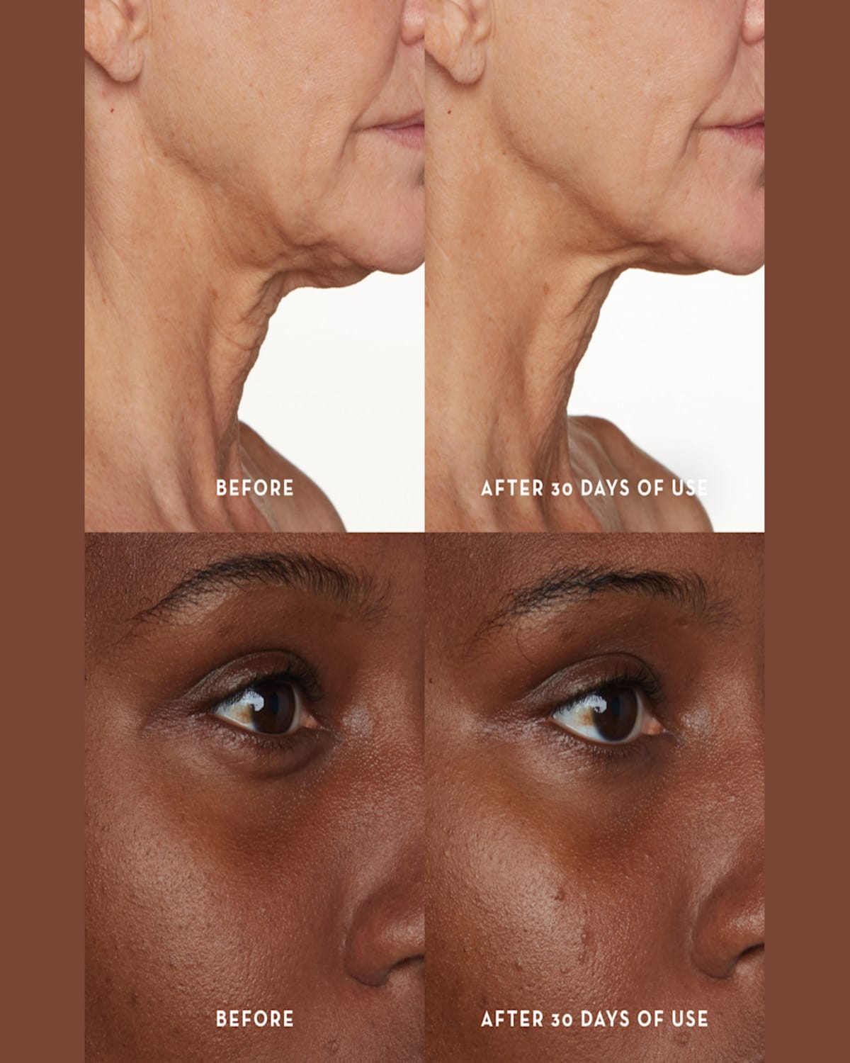 Furtuna Skin 1 Oz. Porte Per La Vitalita Face And Eye Serum