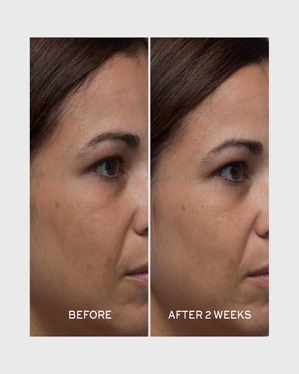 Elemis Pro-collagen Tri-acid Peel, 1 Oz.