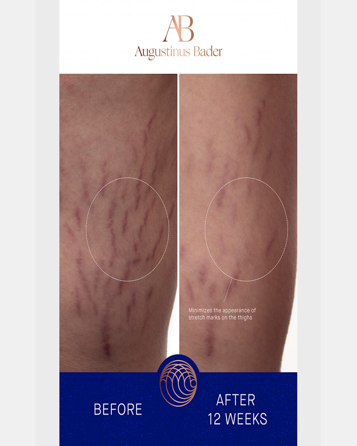 Augustinus Bader Body Cream, 6.8 Oz./ 200 ml