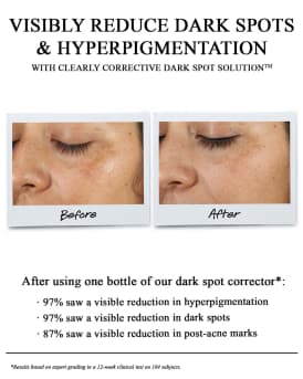 Clearly Corrective Dark Spot Solution