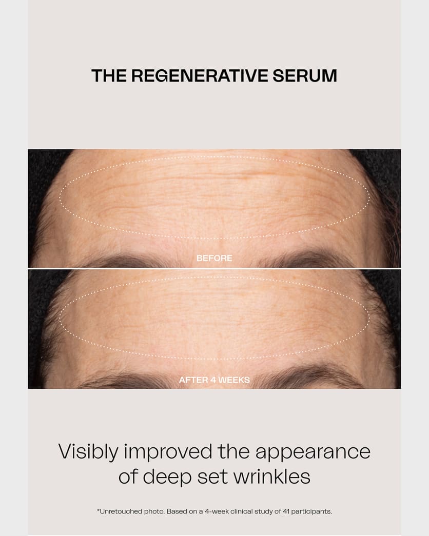The Regenerative Serum