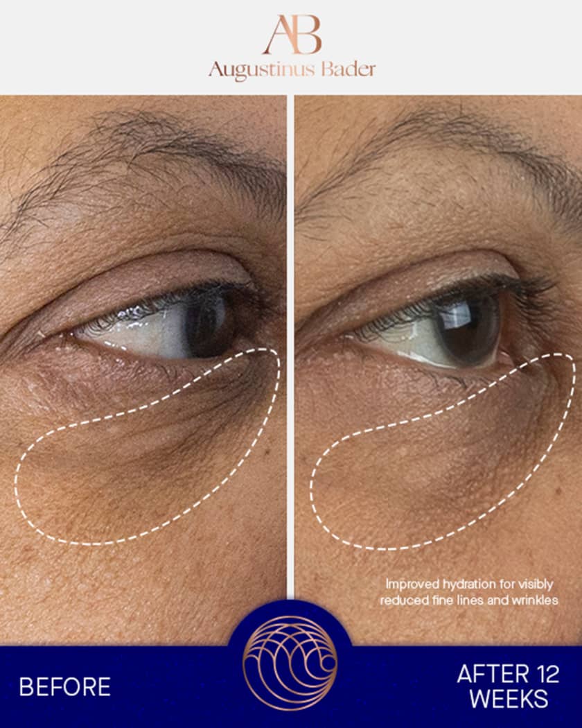 The Eye Cream