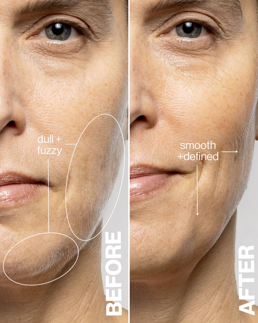 Removing peach fuzz from face sale
