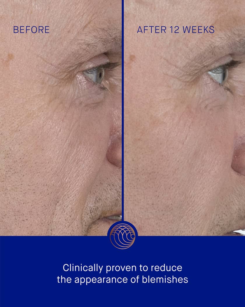 The Serum with TFC8®, 1.7 oz.