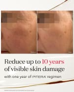 Image 5 of 6: SK-II Facial Treatment Essence, 5.4 oz./160mL