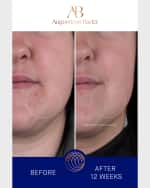 Image 3 of 5: Augustinus Bader The Rich Cream, 1.7 oz.