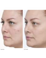 Image 3 of 5: Le Prunier Plumscreen SPF 31 Broad Spectrum UVA/UVB/HEV Protection