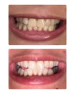 Image 5 of 5: SNOW Oral Cosmetics Electric Toothbrush, Gen 2