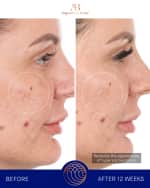 Image 4 of 5: Augustinus Bader The Retinol Serum, 1 oz.