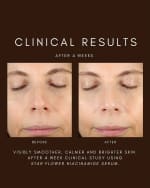 Image 5 of 5: Saint Jane Beauty Star Flower Niacinamide Serum, 1.5 oz.