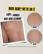 Image 3 of 5: Kiehl's Since 1851 Expertly Clear Acne Treating & Preventing Lotion, 2 oz.