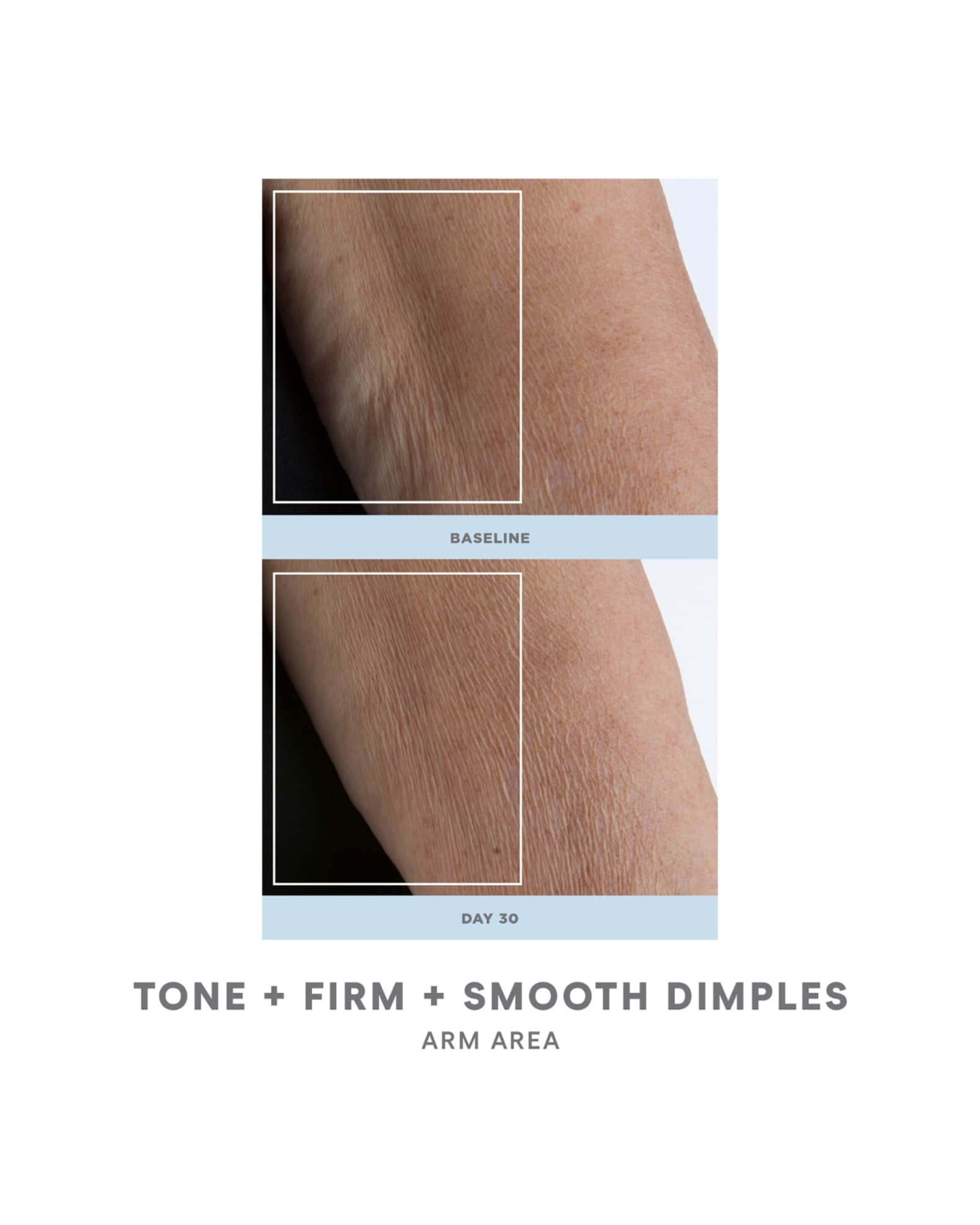 NuFace NuBODY Skin Toning Kit | Neiman Marcus
