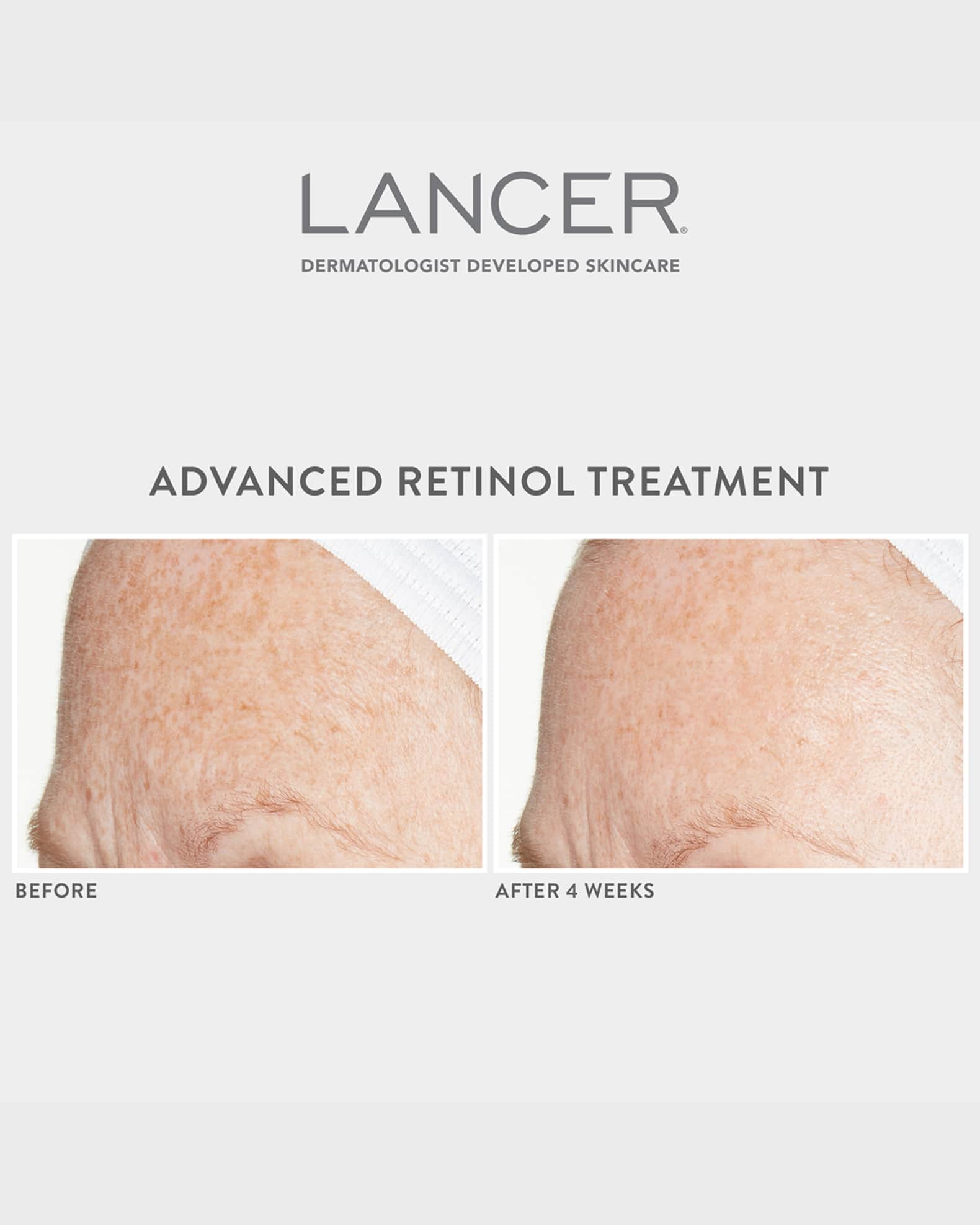 Lancer Advanced Retinol Treatment, 1 oz./ 30 mL Neiman Marcus