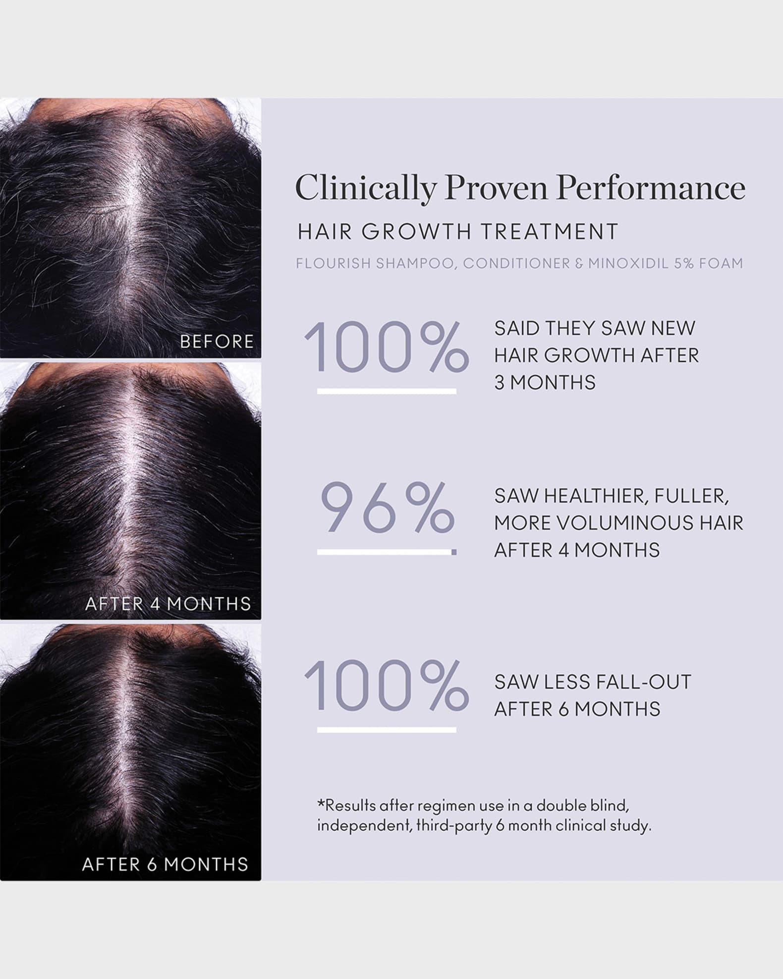 Virtue Flourish Hair Growth Treatment Kit 1month Neiman Marcus