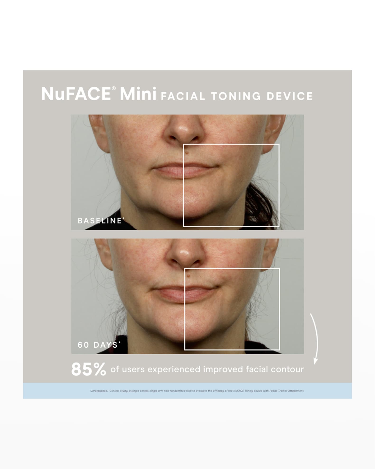 NuFace NuFace Mini Supercharged Skincare Routine Neiman Marcus