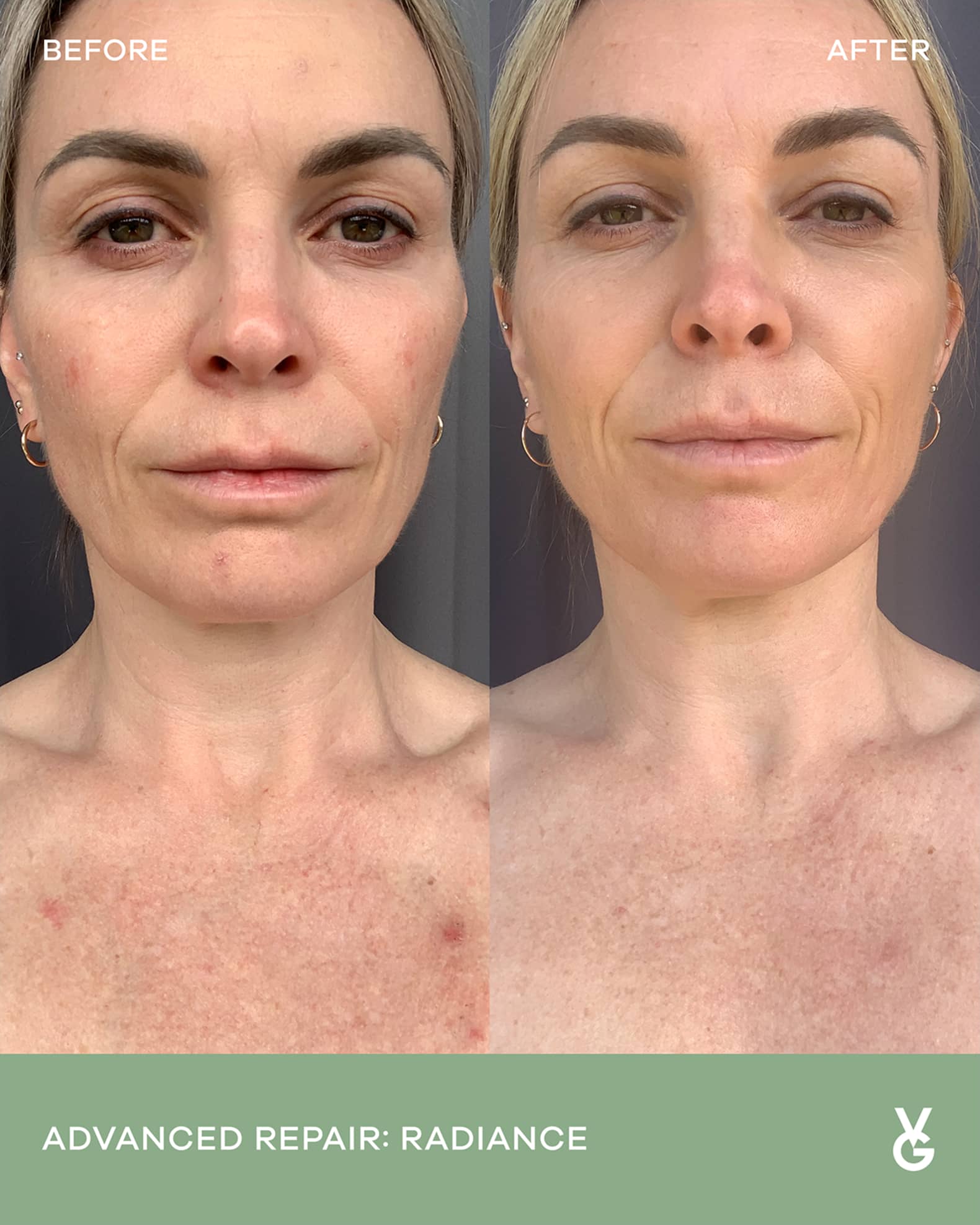 Radiance Advanced Repair Dietary Supplement 1