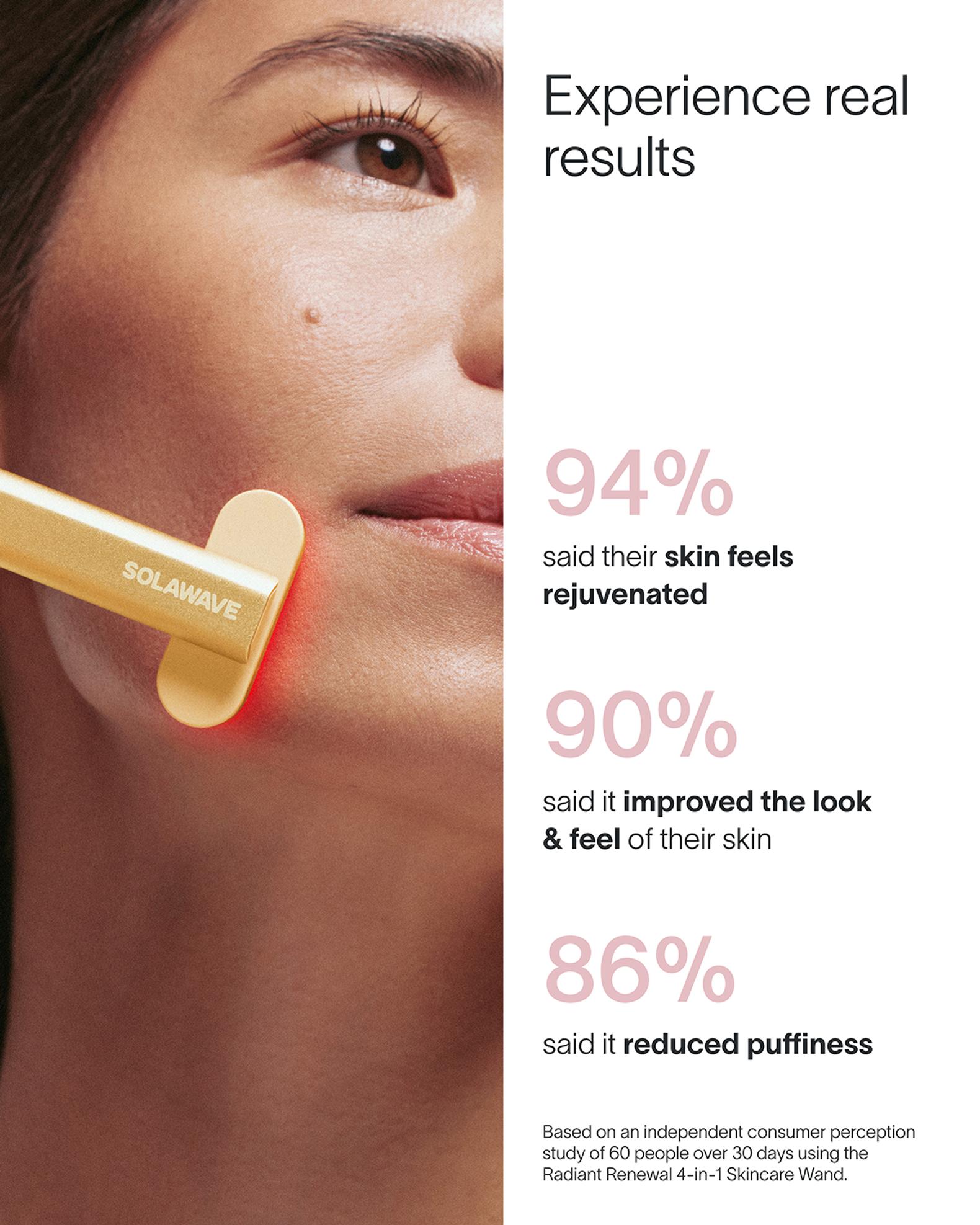 SolaWave 4-in-1 Radiant Renewal Skincare Wand | Neiman Marcus