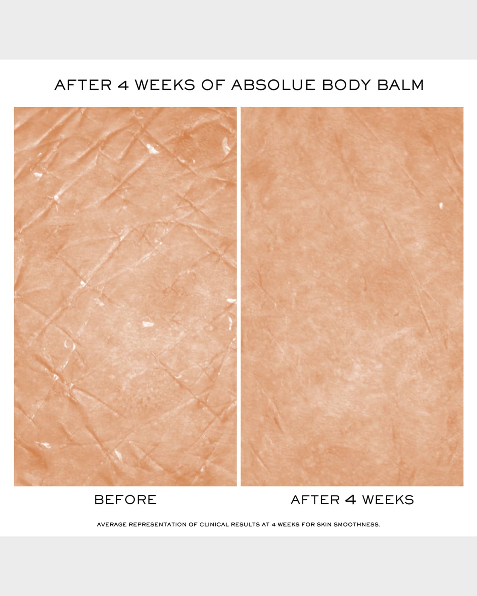 Lancome Absolue Smoothing & Firming Soft Body Balm | Neiman Marcus