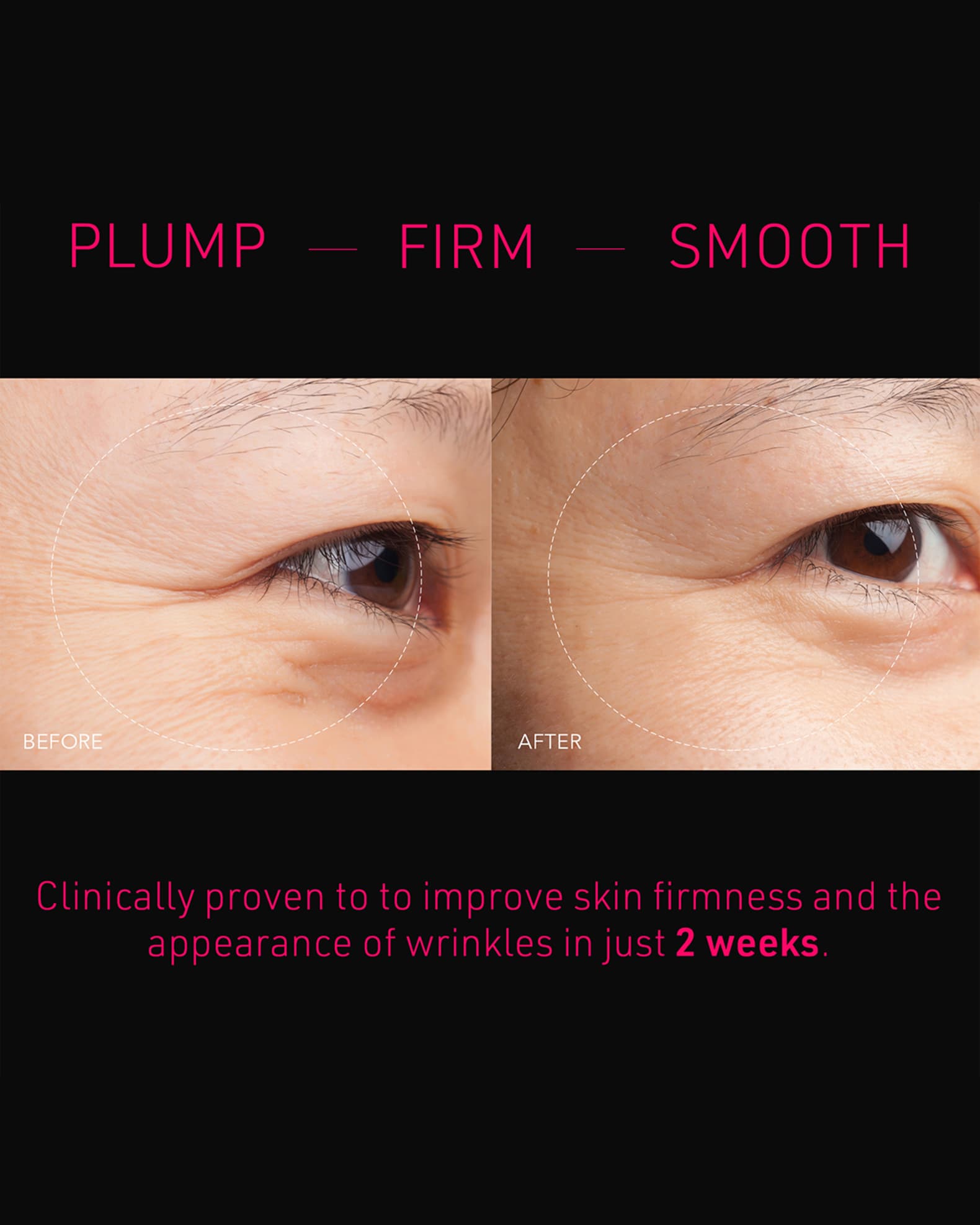 FAQ Microneedling Anti-Wrinkle Hyaluronic Acid Patches For Under Eyes 1