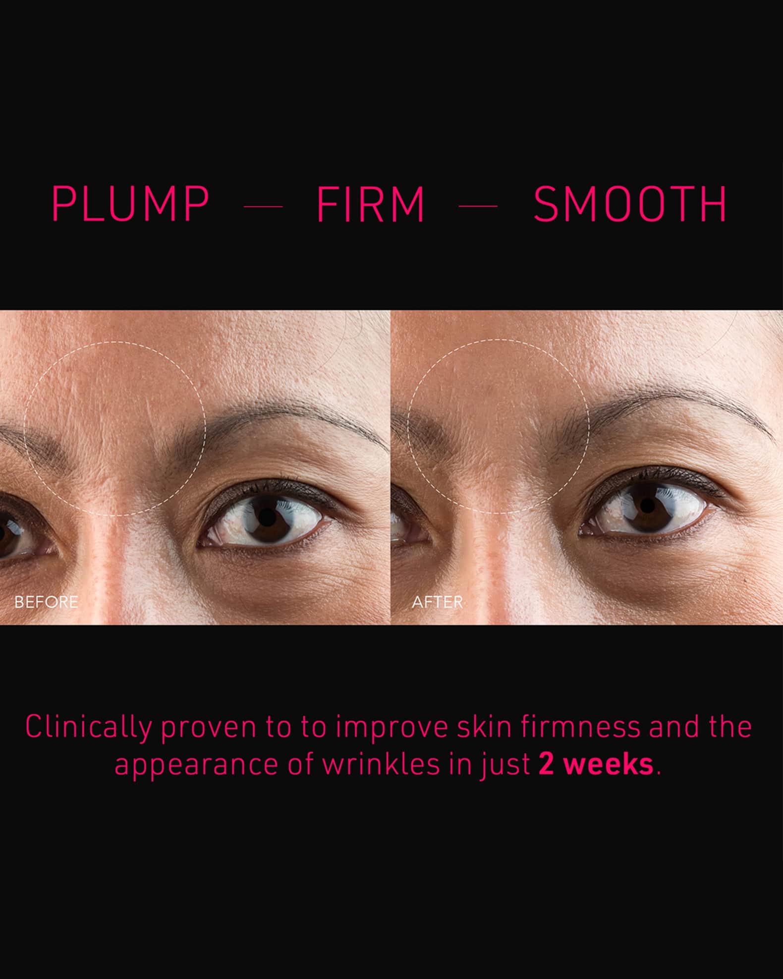 FAQ Microneedling Anti-Wrinkle Hyaluronic Acid Patches For Forehead 1