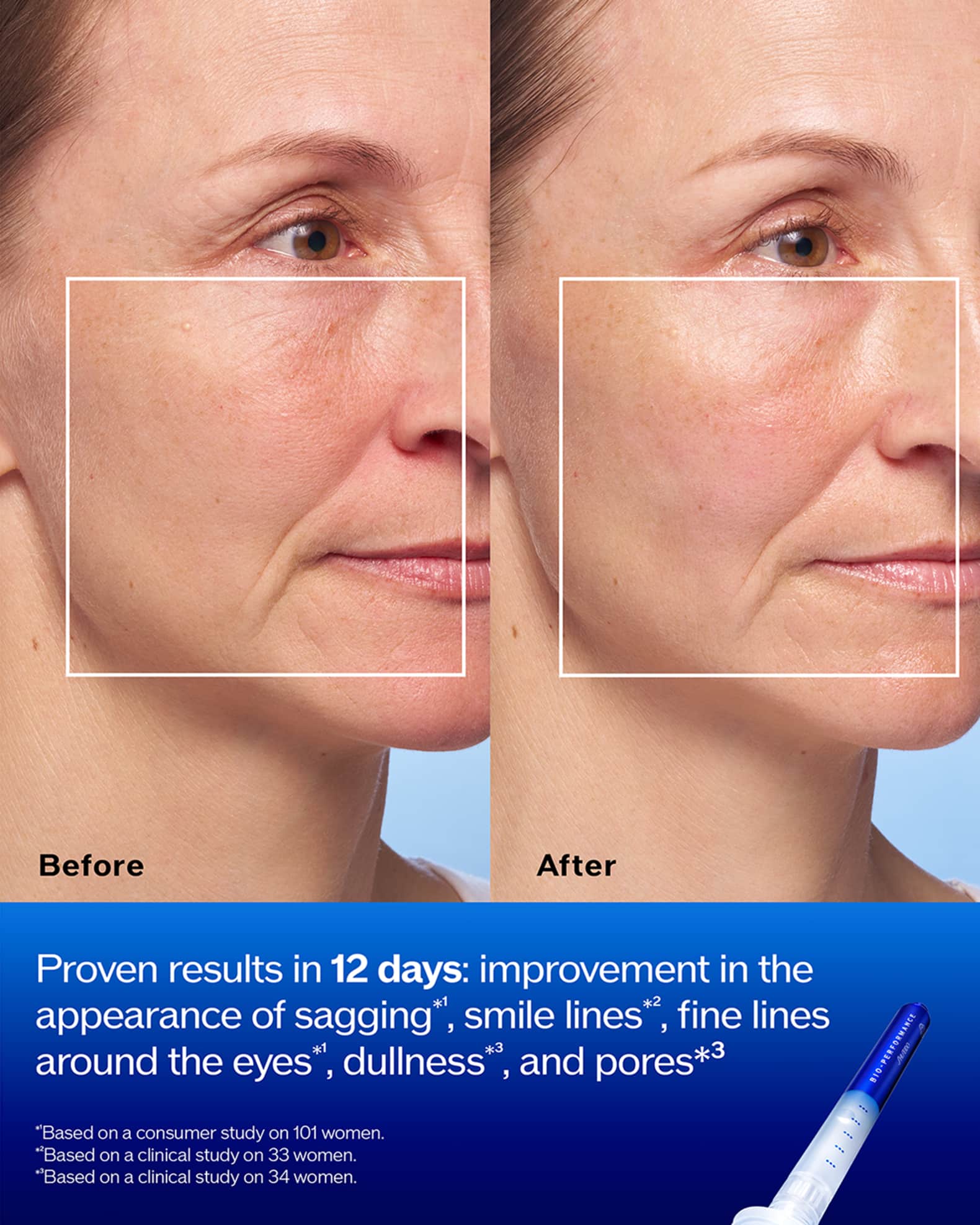 Shiseido Bio-Performance Skin Micro Click Concentrate, 1.4mL