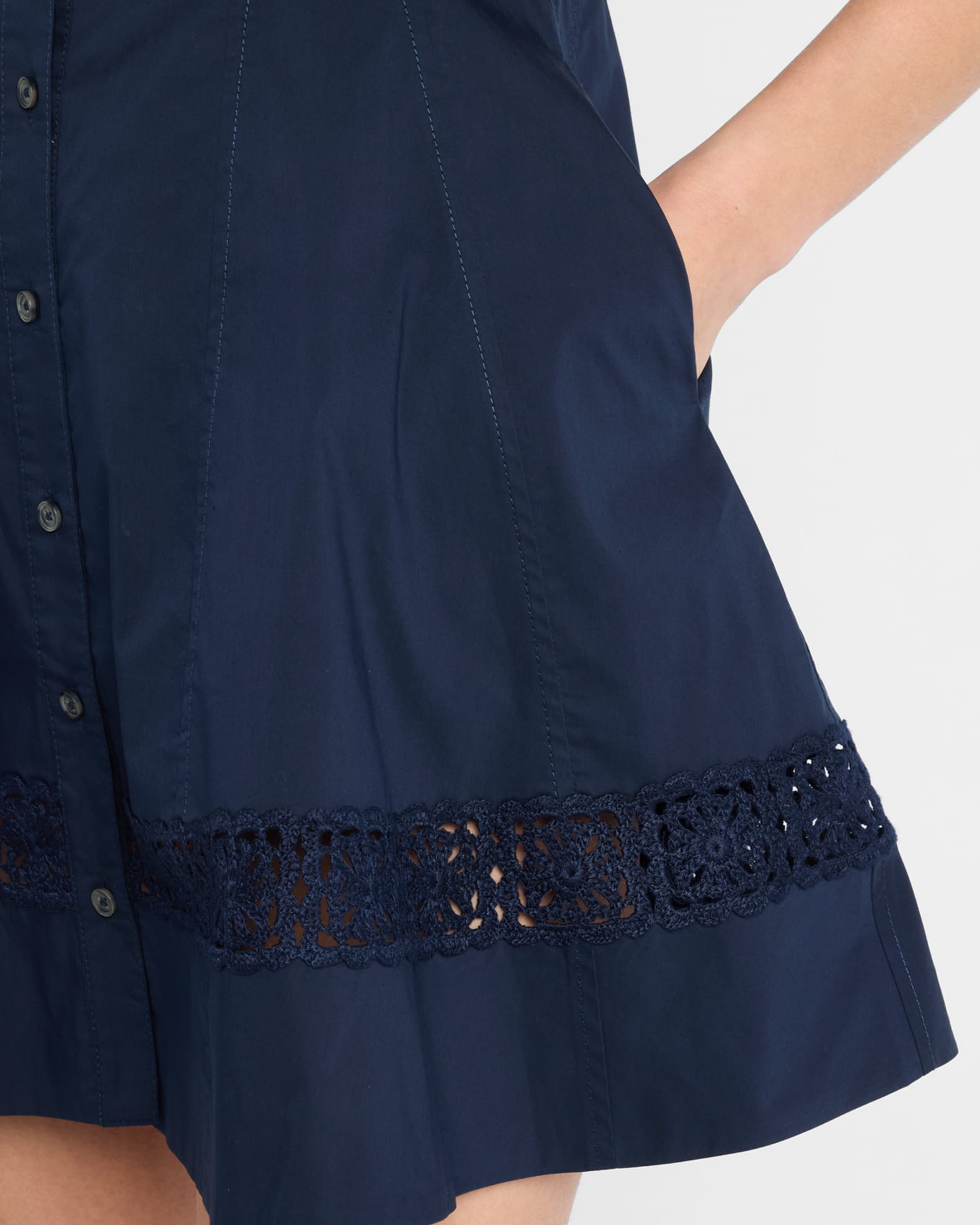 Corinne Button-Front Mini Dress 