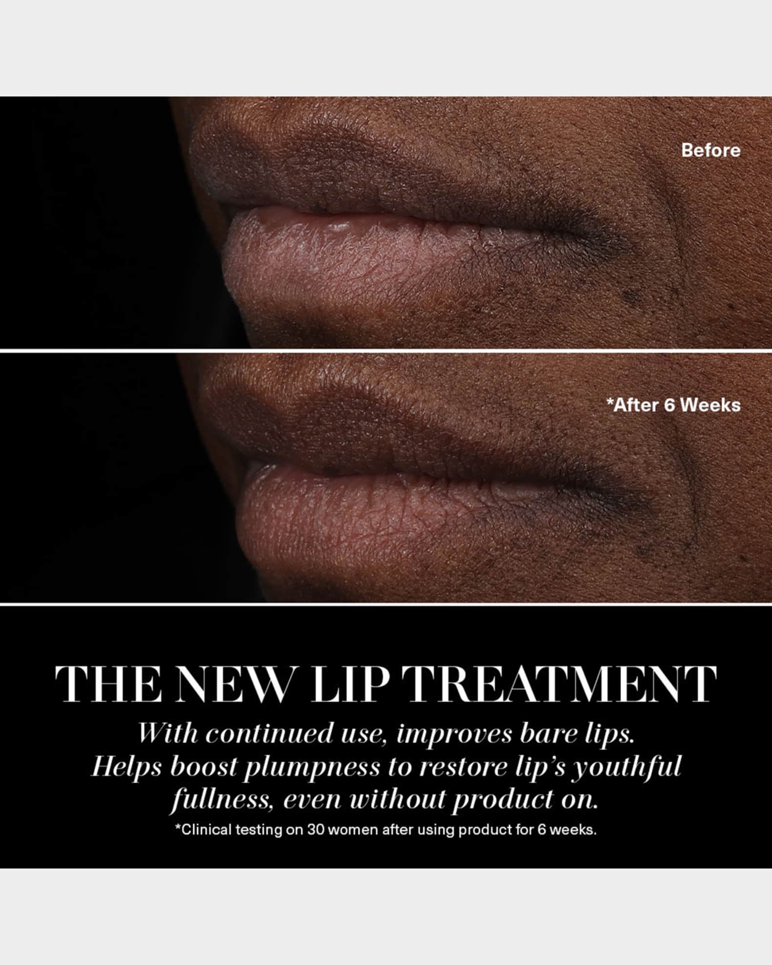 La Mer The Lip Treatment | Neiman Marcus