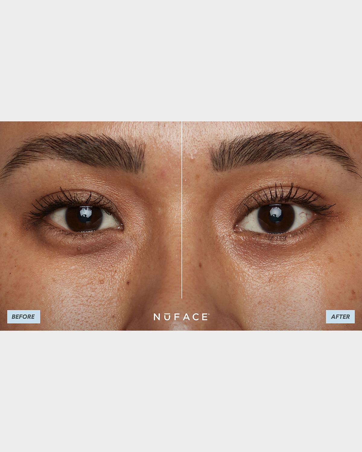 NuFace IonPlex HydraGel Eye Mask, 3.2 oz. | Thumbnail 5 NuFace IonPlex HydraGel Eye Mask, 3.2 oz. | Thumbnail 5