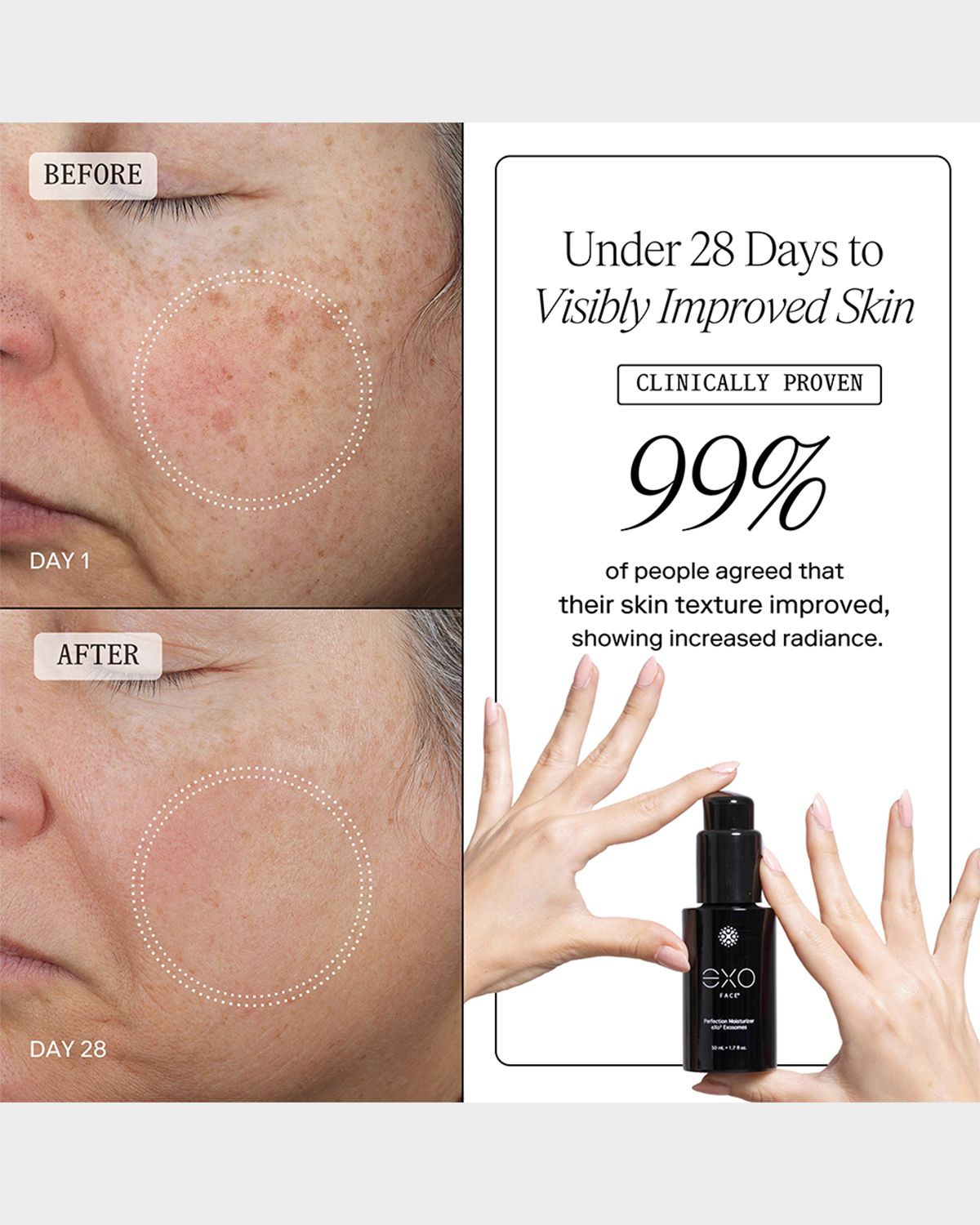 EXOCEUTICALS EXO FACE Perfection Moisturizer, 1.7 oz.